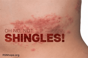 Does Medicare Cover the Shingles Vaccine? What Retirees Should Know